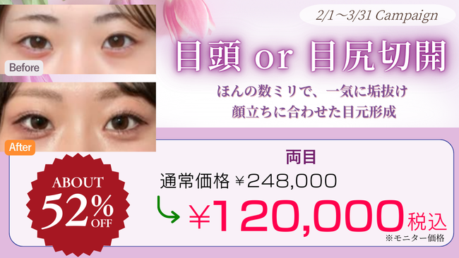 目頭 or 目尻切開