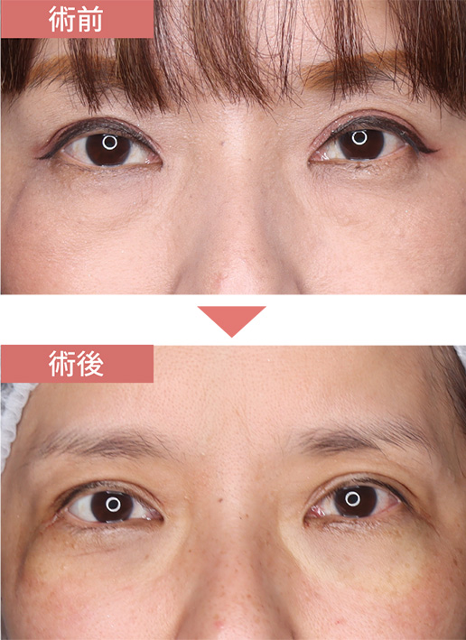 施術前→施術後