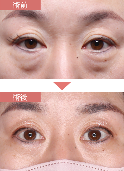 施術前→施術後