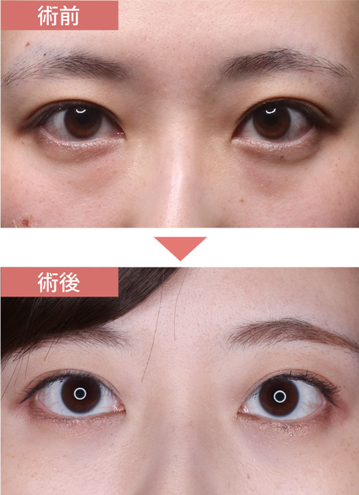 施術前→施術後