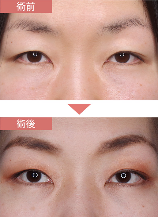 施術前→施術後