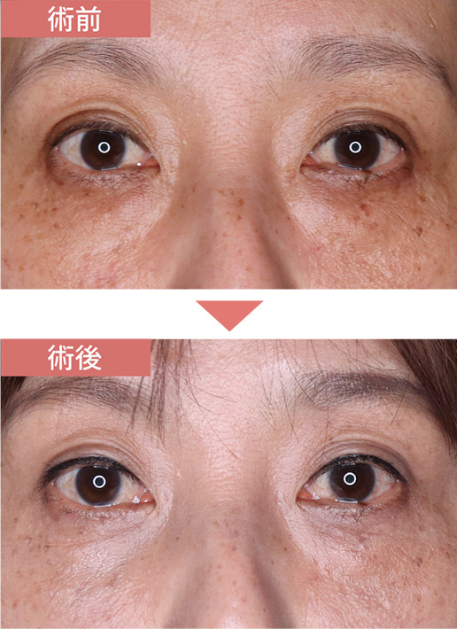 施術前→施術後