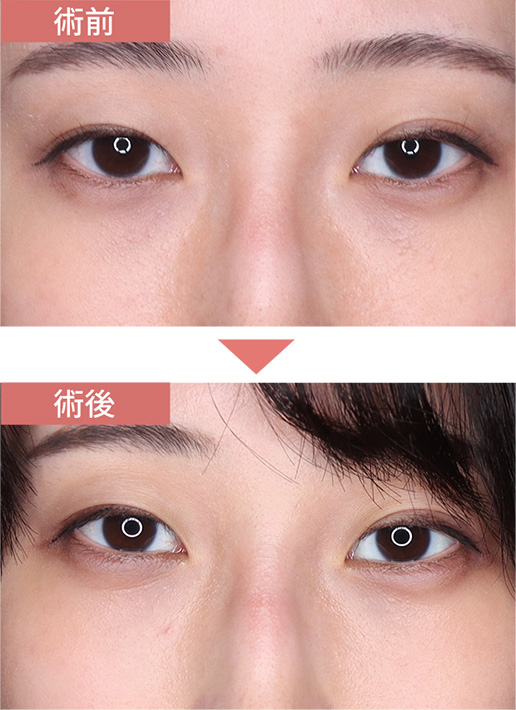 施術前→施術後