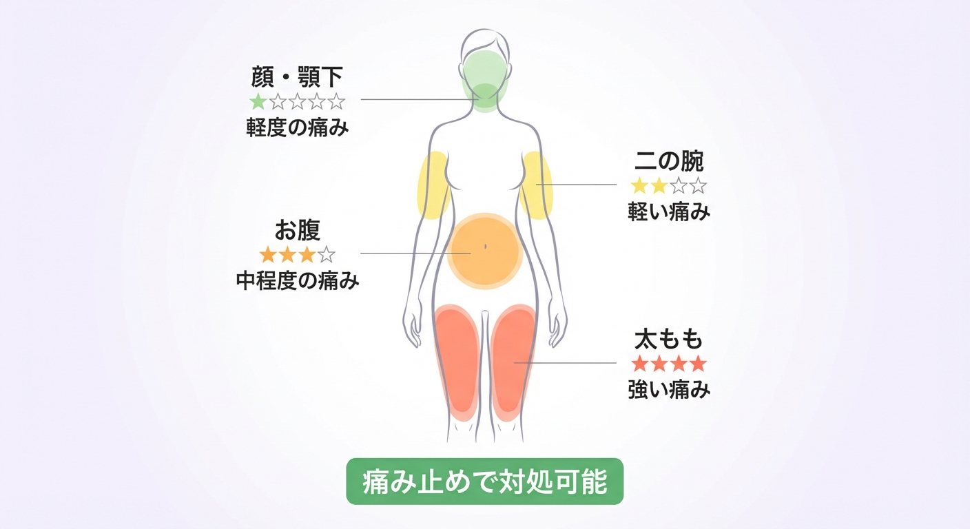 脂肪吸引の部位別の痛みの程度を比較する図解