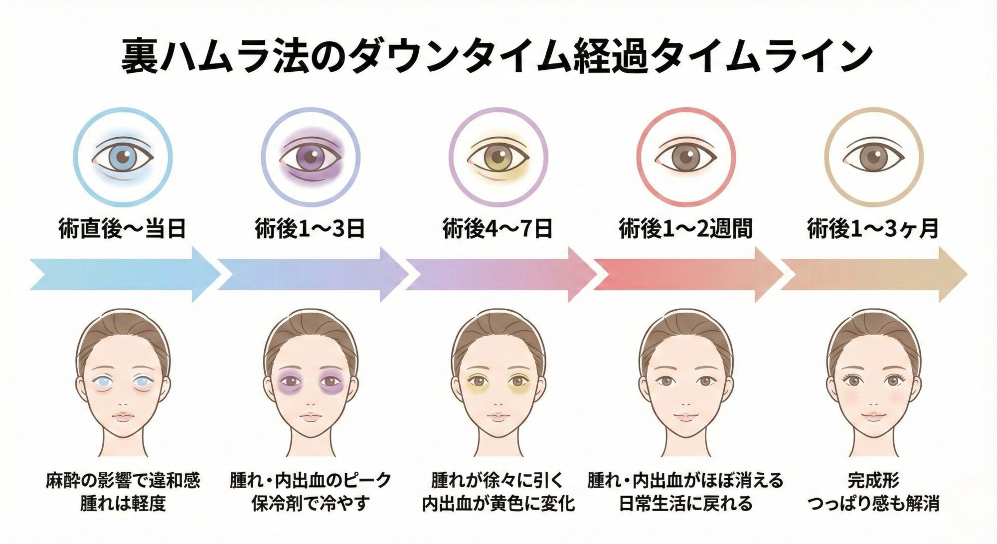 裏ハムラ法のダウンタイム経過タイムライン図解